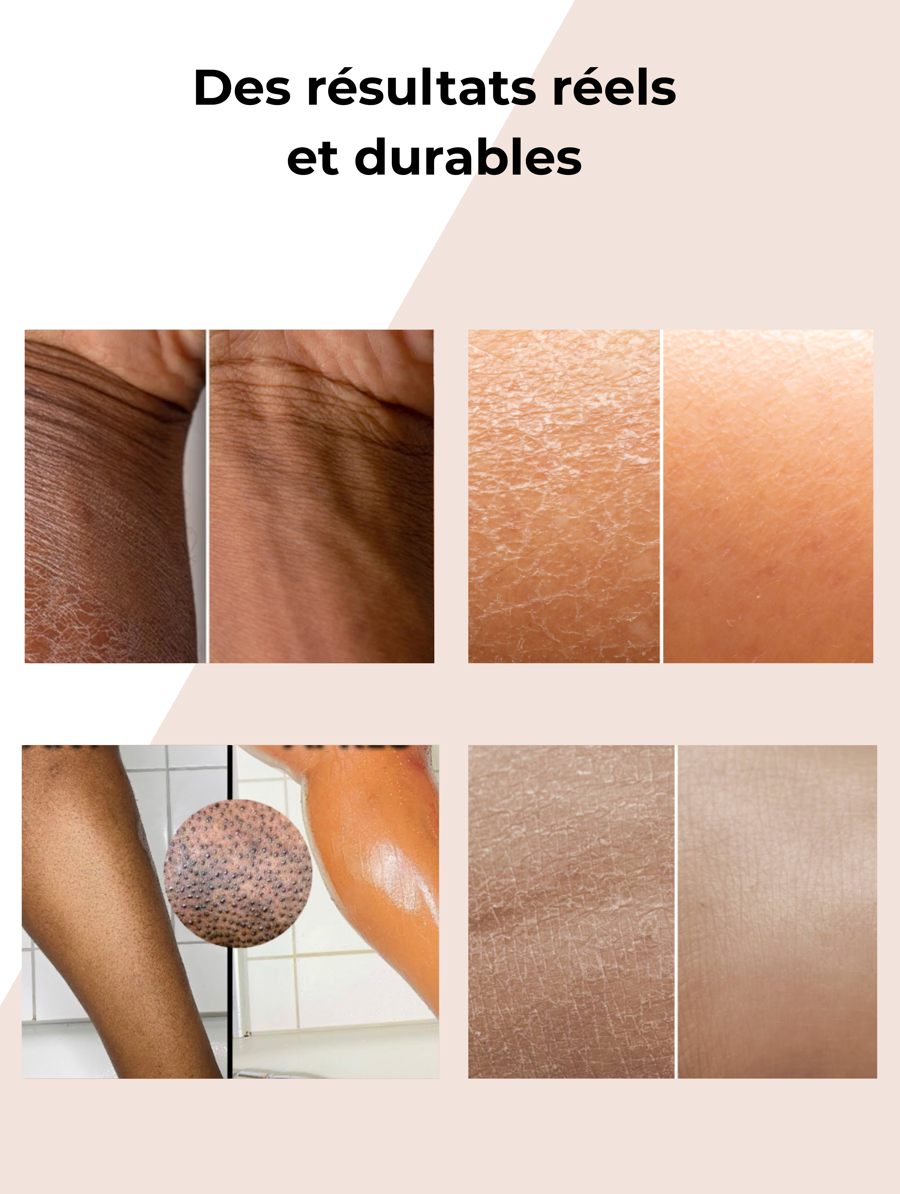 Lotion Corps hydratante 5% urée + 2% panthénol