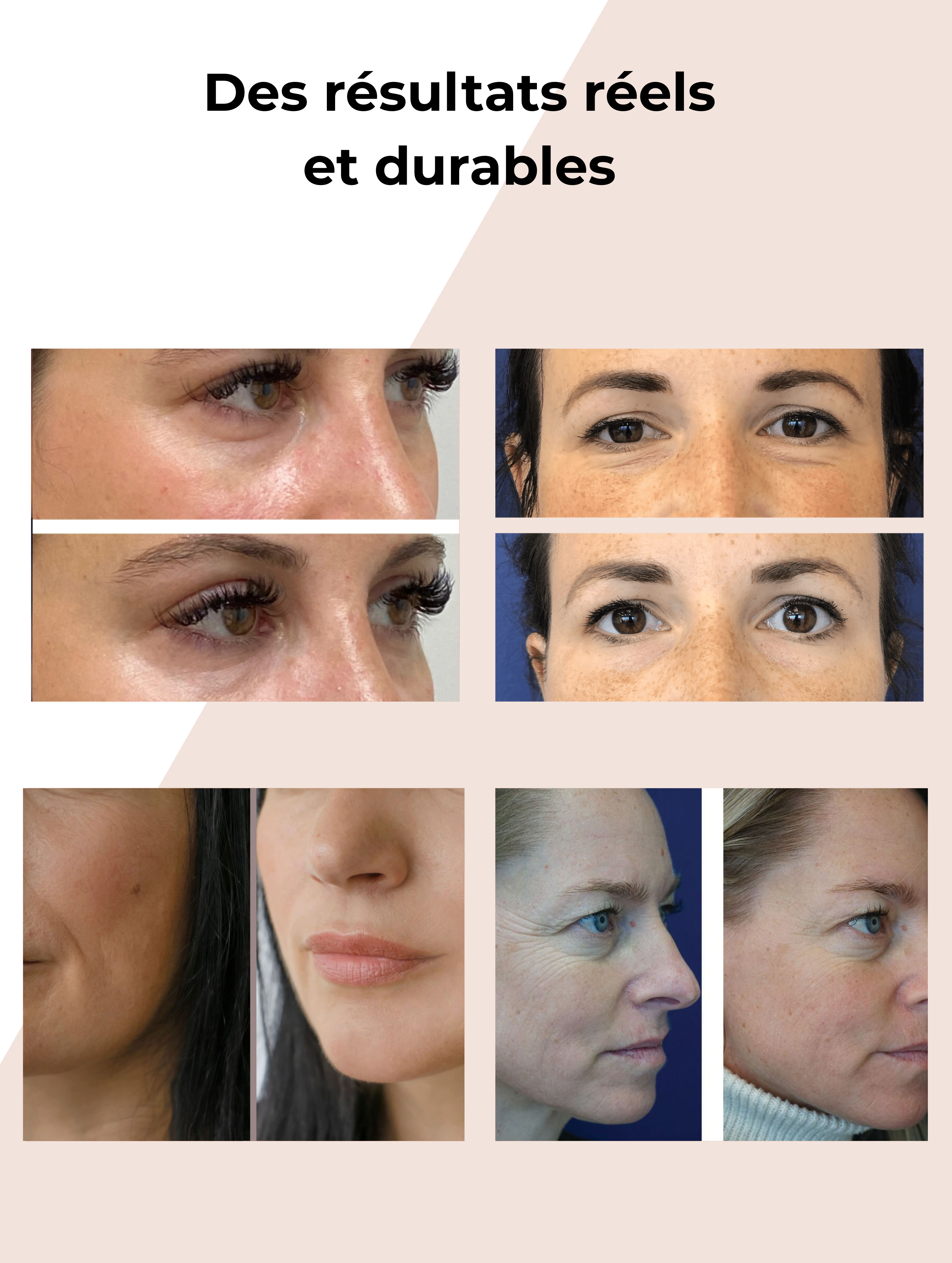 Gel booster pour le visage et les yeux à la caféine Onaé paris tous types de peaux - résultats avant après